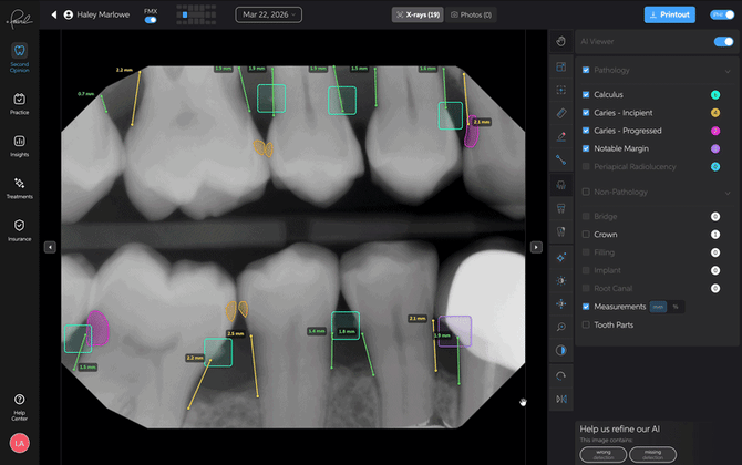 ScreenRecording2026-03-27at3.24.57PM-ezgif.com-video-to-gif-converter